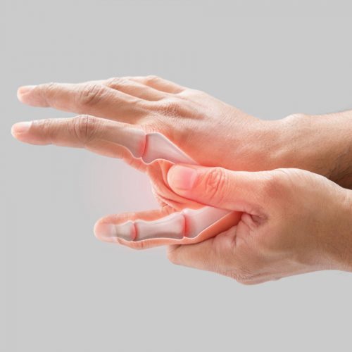 Soothe Your Aching Joints: Studies have shown that Curcumin may help to relieve pain and inflammation in arthritic joints